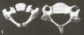 Cervical vertebrae for a one-year old
